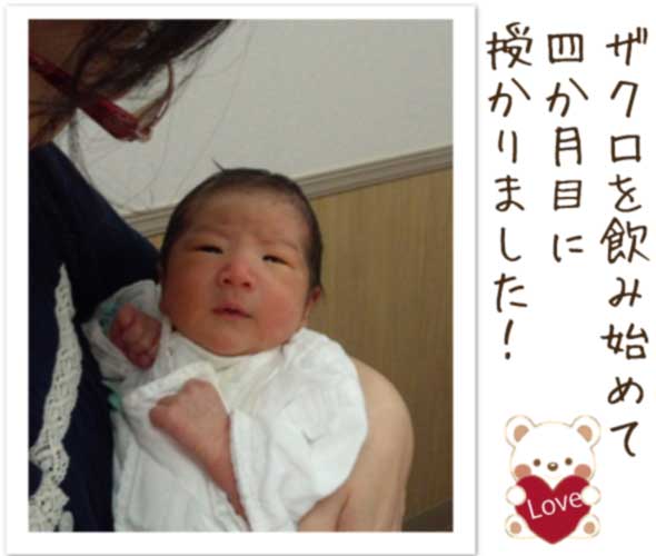 生まれたてのかわいいザクロベビーの写真