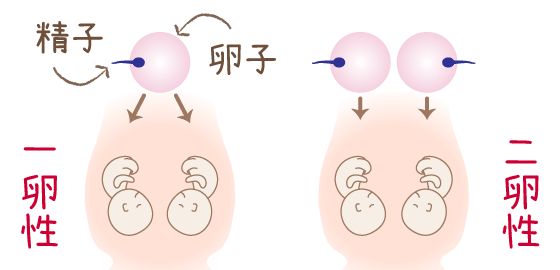 双子の種類を図解